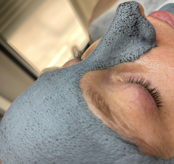 Zabieg silnie oczyszczający PCA SKIN z peelingiem kawitacyjnym